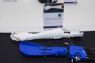 Foto de una prótesis de mano y antebrazo